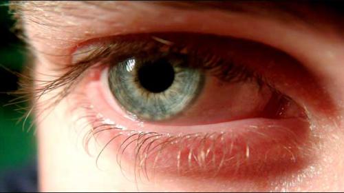 Uk Scientists Start Stem Cell Trial Of Potential Blindness Cure