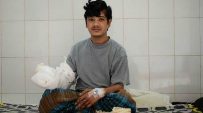 Bangladesh 'Tree Man' sees hope after 16 surgeries