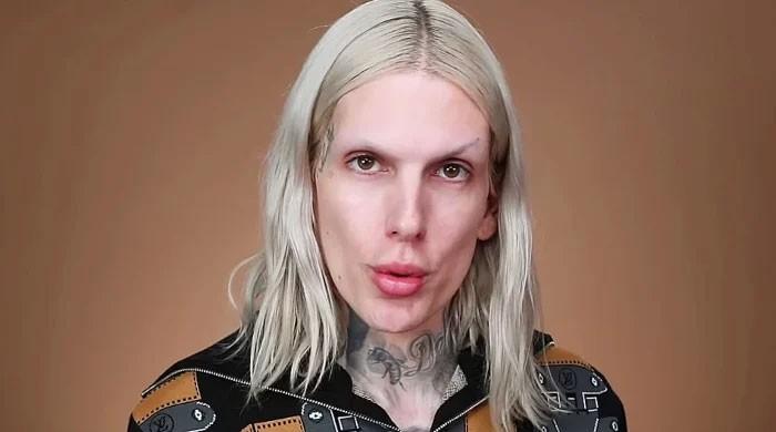 Jeffree Star Has to Wear Back 'Brace for Few Months' After Wyoming Crash