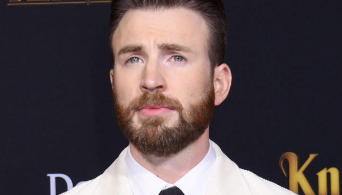 Chris Evans shares images of bruised arms while working on Netflix movie