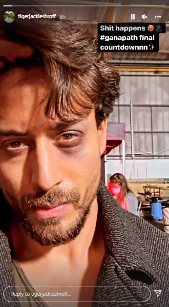 Tiger Shroff drops picture of his eye injury amid ‘Ganapath: Part 1’ shoot