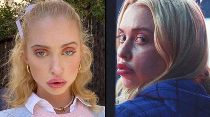 Euphoria Star Chloe Cherry Annoyed By Bizarre Comments About Her Lips