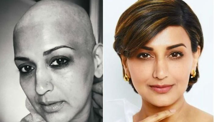 Sonali Bendre was diagnosed with metastatic cancer in 2018 and has made full recovery since