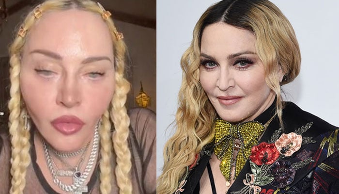 Madonna sparks concern with 'unsettling' pre-Grammys video