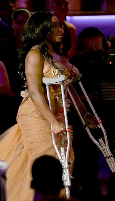 SZA shares how she got her ankle injured right before Grammys