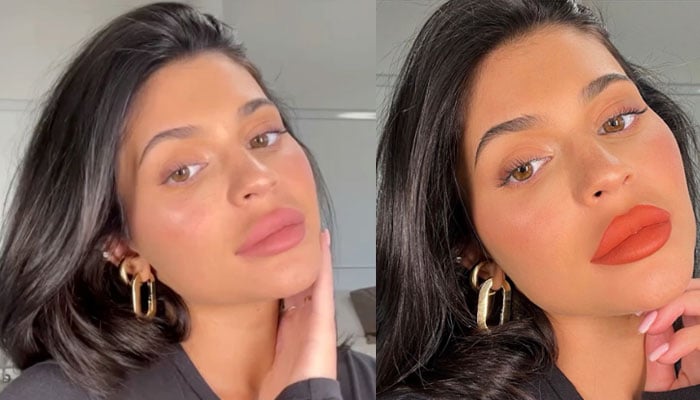 Kylie Jenner Lips Before After Lipstutorial Org