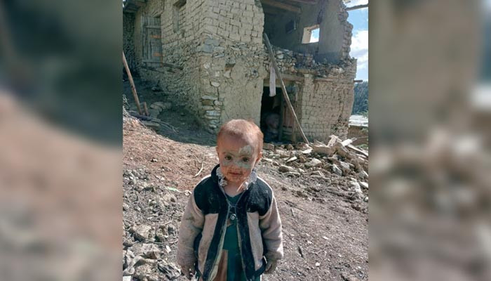 A heartbreaking image of an Afghan child after the earthquake is spreading quickly