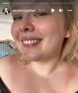 Bridgerton star Nicola Coughlan shares after-effect of wearing regency gown: Photo