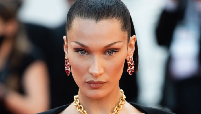 Fans react to Bella Hadid pictures featuring bruises on her legs: ‘What