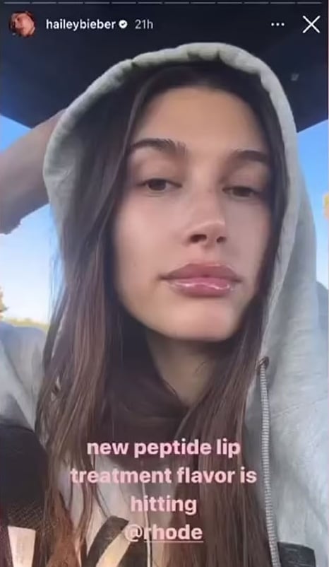 Hailey Bieber sparks speculations over lip fillers as she models over-plumped pout