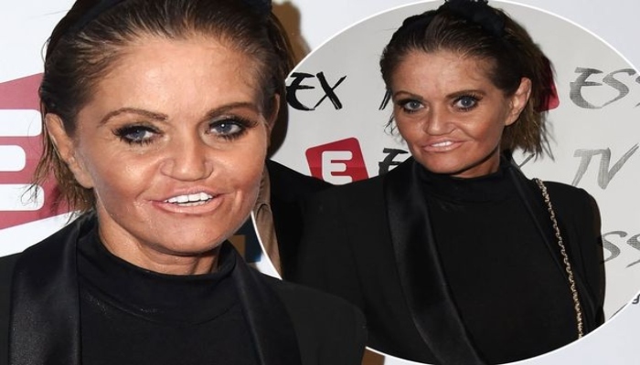 Danniella Westbrook ‘excited About Her New Look After Surgery 5085