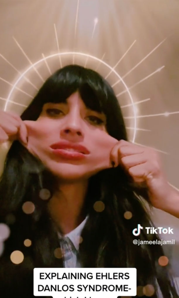 Jameela Jamil addresses battle with rare tissue disorder