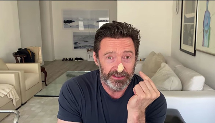 Hugh Jackman reveals biopsies results, thanks fans for love and support