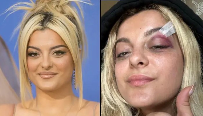 Bebe Rexha fan breaks silence, reveals motive behind phone throw