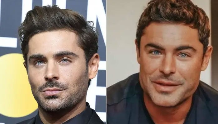 Zac Efron goes under the knife for multiple face changes?