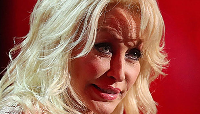 Dolly Parton gets honest about plastic surgery