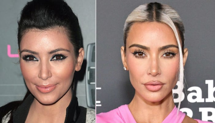 Kim Kardashians most likely cosmetic procedures that make her look flawless have been revealed