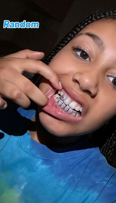 Kanye West, Kim Kardashian’s daughter North flaunts her new diamond grills