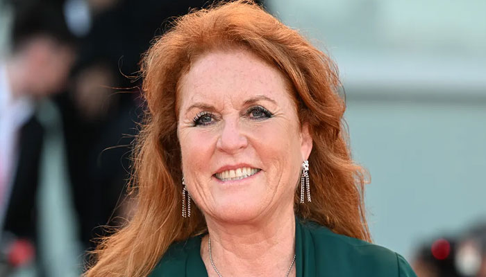 Sarah Ferguson skin cancer diagnosis: What do the symptoms entail?