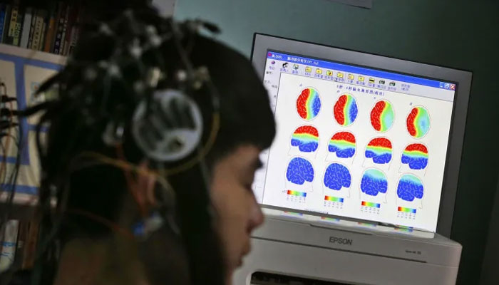 Unique brain activity patterns spotted in creative thinkers.—REUTERS