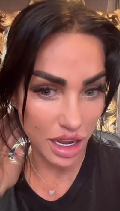 Katie Price goes natural days after lip filler treatment