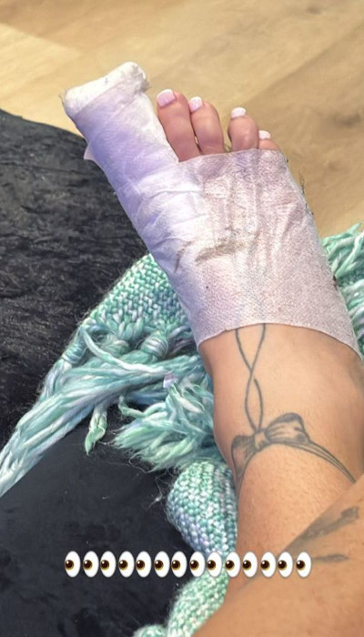 Katie Price shares painful injury with fans on social media