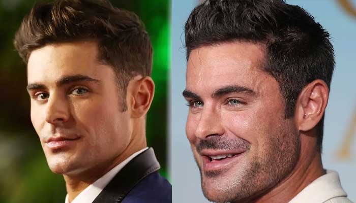 Plastic surgeon finally reveals what's happened to Zac Efron's face