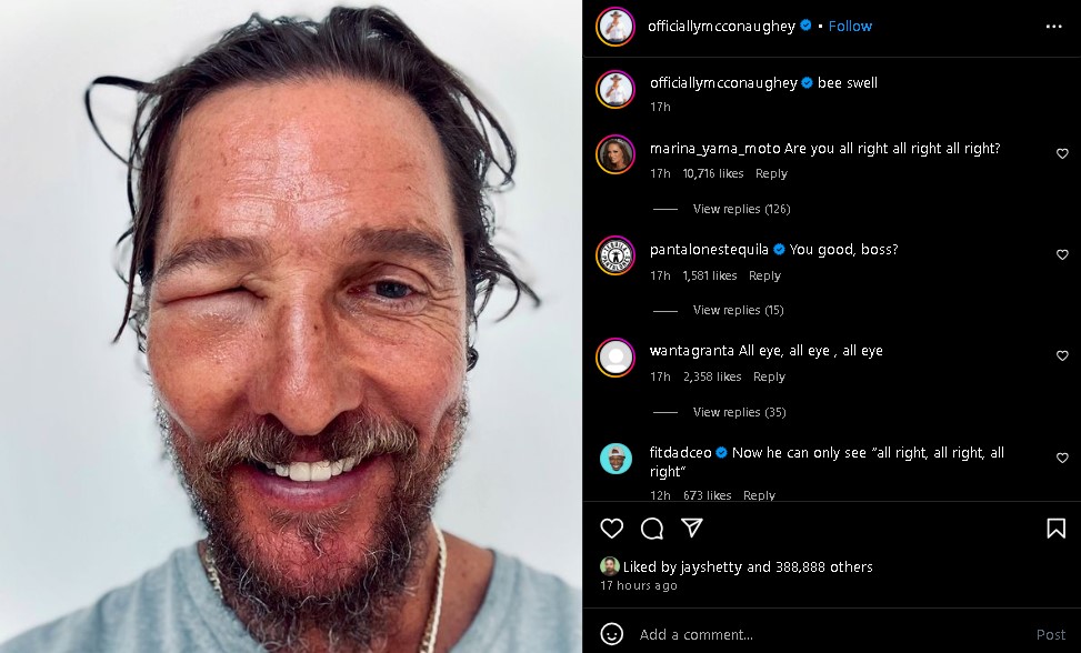 Matthew McConaughey shared unrecognizable photo of himself after injury