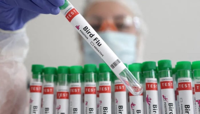 A medical practitioner looking at a bird flu test sample. —Reuters/ File