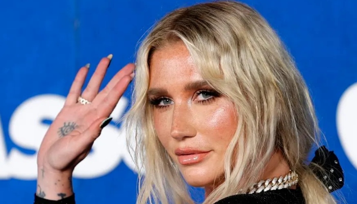 Photo: Kesha shares what she wants to do until the day she dies