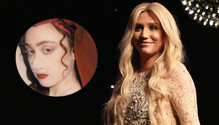 Kesha makes shocking revelation about Chappell Roan