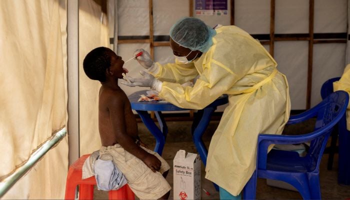 A child infected with the mpox virus being treated by a nurse in Nyiragongo territory near Goma, North Kivu province, Democratic Republic of the Congo on July 19, 2024. — Reuters