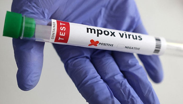 A test tube labelled Mpox virus positive is held in this illustration taken August 20, 2024. — Reuters