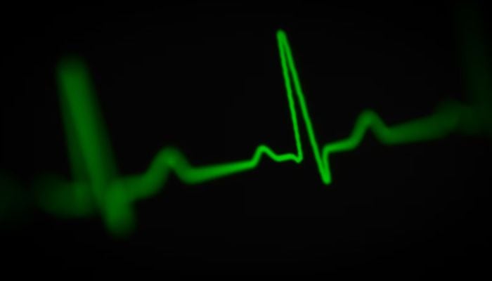 Heartbeat of a human on a monitor display. — Unsplash/File