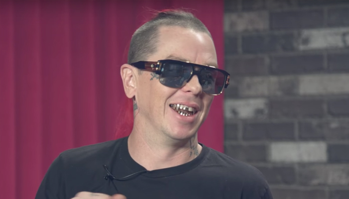 Sid Wilson takes the stage for mentally taxing show after burn accident