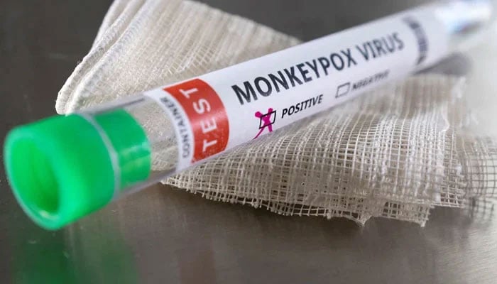 Test tube labelled Monkeypox virus positive is seen in this illustration taken May 22, 2022. — Reuters