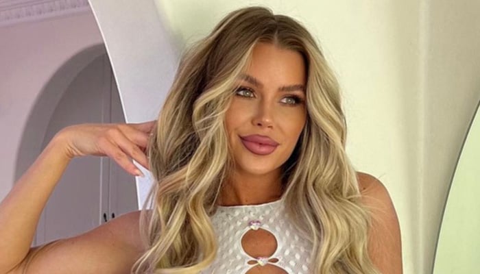 Skye Wheatley reacts to backlash over her cosmetic surgeries