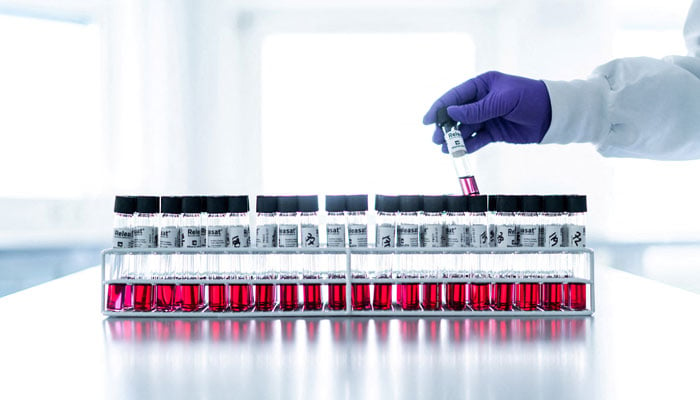 A Bavarian Nordic research team member holding a test tube. — Reuters/File