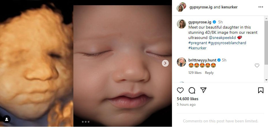 Gypsy-Rose Blanchard unveils 4D ultrasound of baby girl