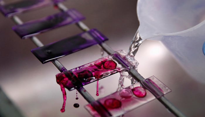 A health technician analyses blood samples for tuberculosis testing in a high-tech tuberculosis lab in Carabayllo in Lima, Peru May 19, 2016. — Reuters