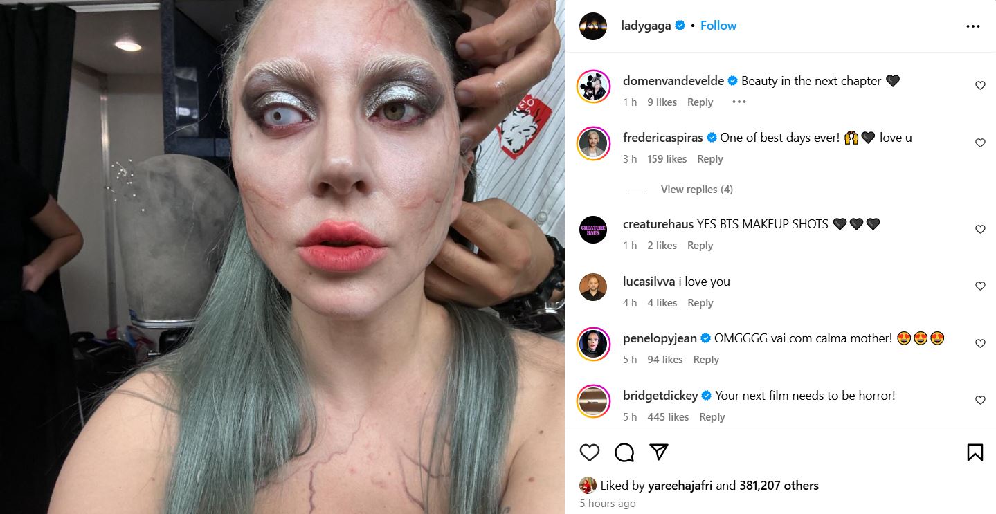 Lady Gaga excites fans with BTS snaps of Disease amid song hype