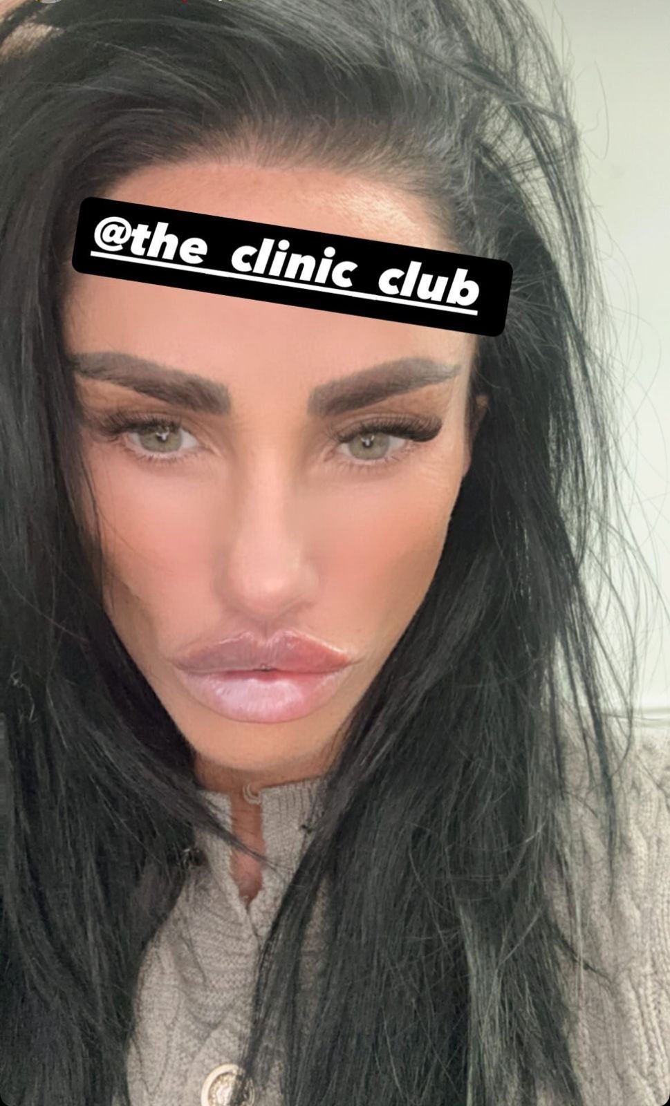 Katie Price flaunts brand new, ‘biggest lip shes ever got