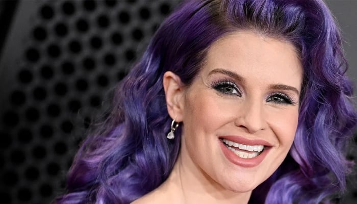 Photo: Kelly Osbourne shuts down plastic surgery rumours