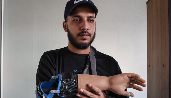 A protester who lost his arm in Julys students revolution holds a prosthetic arm manufactured by Robolife Technologies in Dhaka on November 21, 2024. — AFP