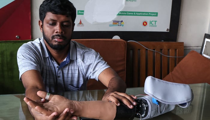 A man shows a prosthetic arm manufactured by Robolife Technologies for protesters who lost their arm in Julys students revolution in Dhaka on November 21, 2024. — AFP