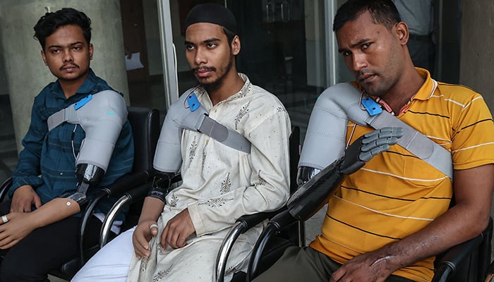 Protesters who lost their arm in July´s students revolution test out prosthetic arms manufactured by Robolife Technologies in Dhaka on November 21, 2024. — AFP