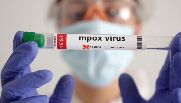 A test tube labelled Mpox virus positive is held in this illustration taken on August 20, 2024. — Reuters