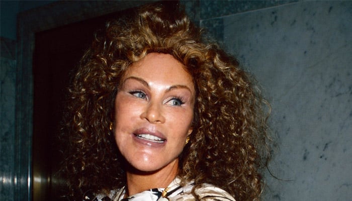 Catwoman Jocelyn Wildenstein breathes her last at 84