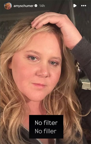 Amy Schumer shares flaunts her bare face after Cushing Syndrome diagnosis