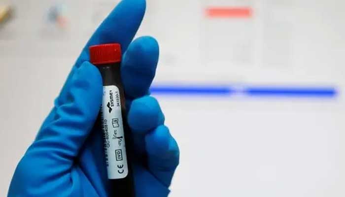 A PSB spokesperson says a total of 140 anti-doping tests were conducted in 2024. — Reuters/File